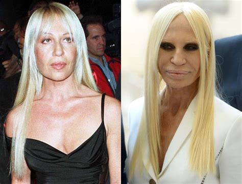 commento donatella versace|donatella versace before and after surgery.